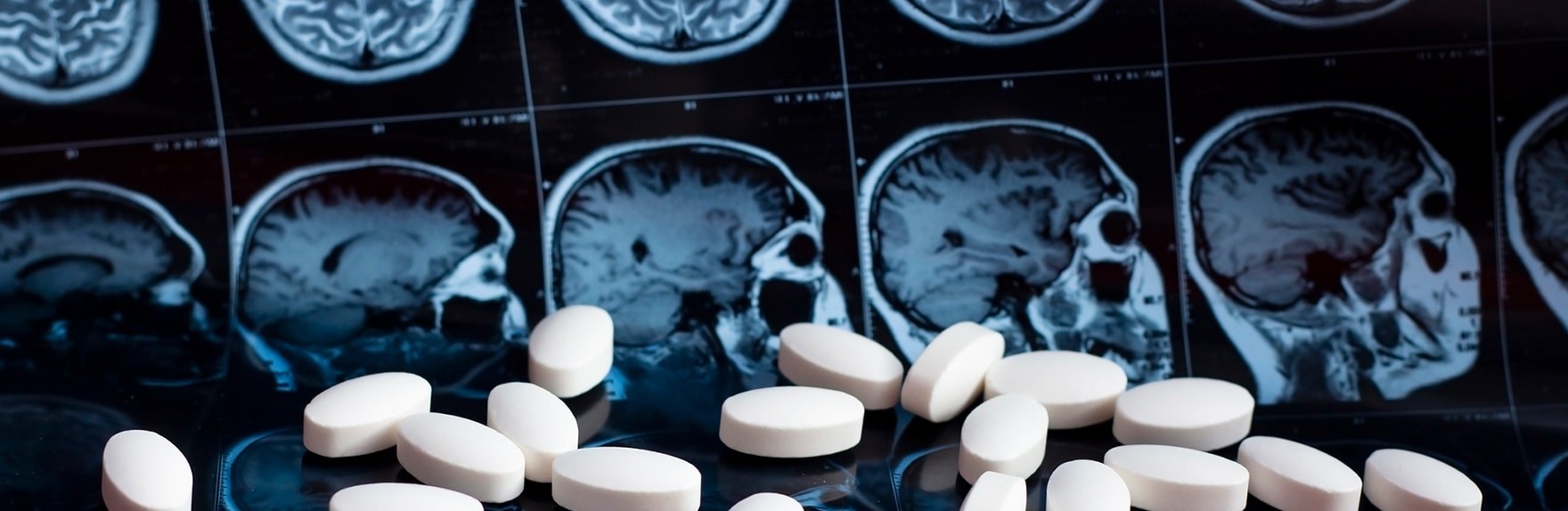Quels sont les effets de la drogue sur le cerveau?